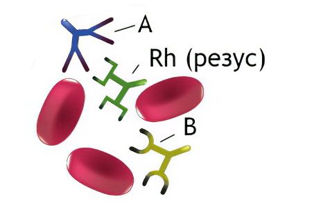 Blood transfusion: complications, indications, preparation