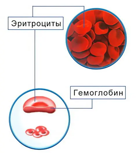 Blood transfusion: complications, indications, preparation