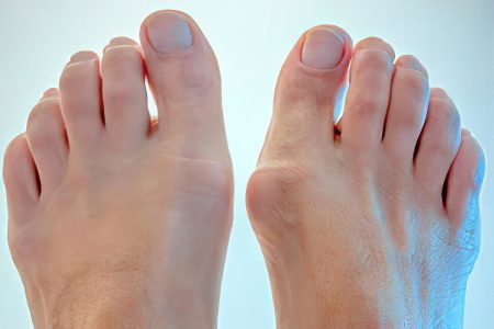 Bumps on the legs at the big toe: causes and treatment