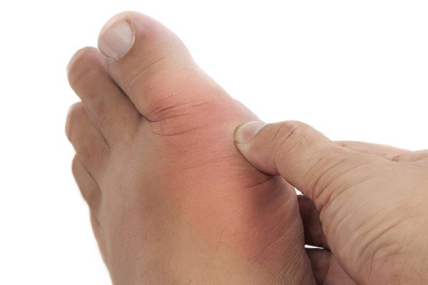 Bumps on the legs at the big toe: causes and treatment