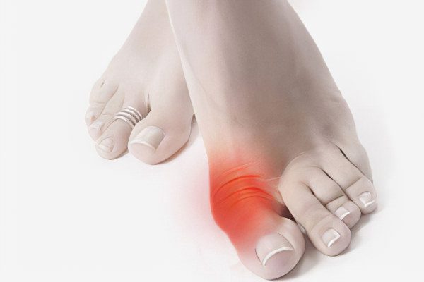 Bumps on the legs at the big toe: causes and treatment