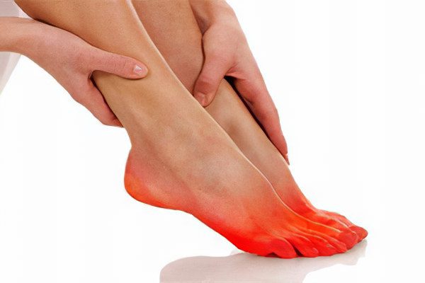 Burning feet: what to do?