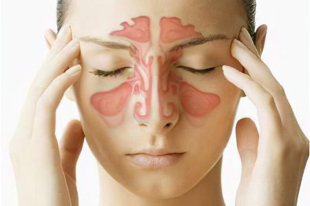 Causes and symptoms of a runny nose, how to treat?