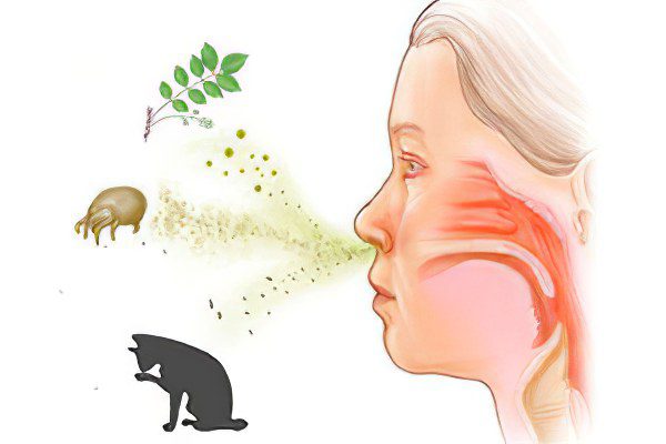 Causes and symptoms of a runny nose, how to treat?