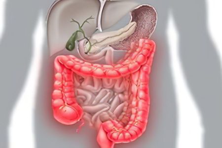 Causes and symptoms of acute and chronic intestinal colitis