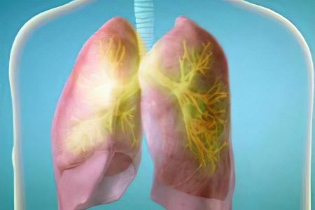 Causes and symptoms of bronchitis