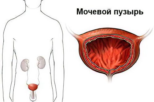 Causes and symptoms of inflammation of the bladder