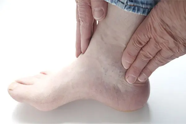 Causes and symptoms of tendovaginitis of the ankle joint