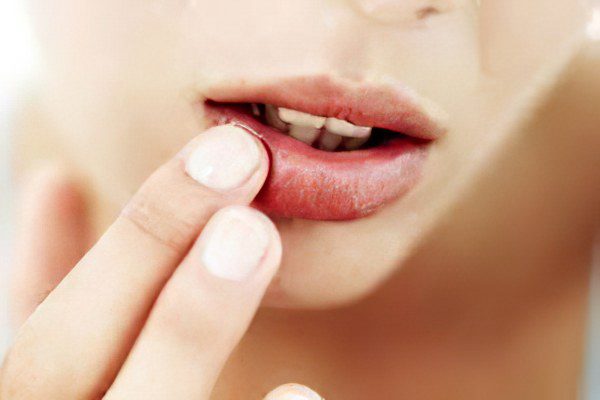 Causes and treatment of herpes on the lips in children and adults