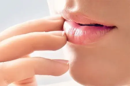 Causes and treatment of herpes on the lips in children and adults