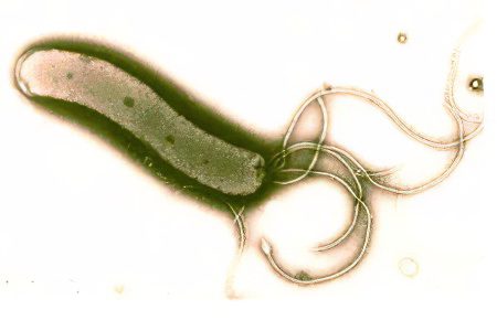 Causes, forms and symptoms of Helicobacter pylori