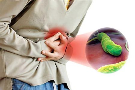 Causes, forms and symptoms of Helicobacter pylori