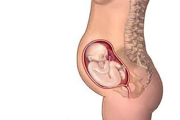 Causes, symptoms and how to treat hemorrhoids during pregnancy?