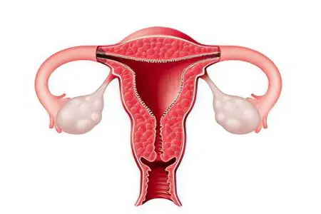 Causes, symptoms and methods for removing endometrial irrigations