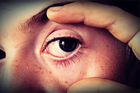 Causes, symptoms and prevention of cataracts, eye drops