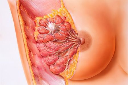 Causes, symptoms and treatment of breast cysts