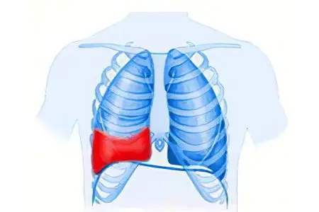 Causes, symptoms and treatment of hemothorax