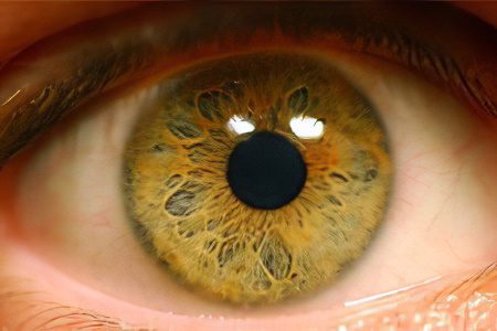 Causes, symptoms and treatment of retinal angiopathy