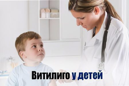 Causes, symptoms and treatment of vitiligo in children