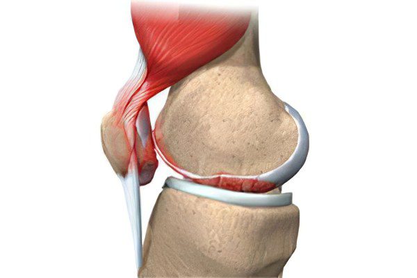 Causes, symptoms of arthrosis, its complications and treatment methods