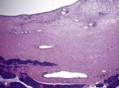 Changes in the parenchyma of organs