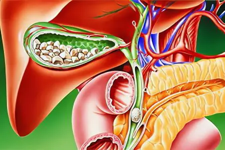 Cholagogue drugs: a review of 14 manufacturers