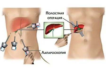 Cholagogue drugs: a review of 14 manufacturers