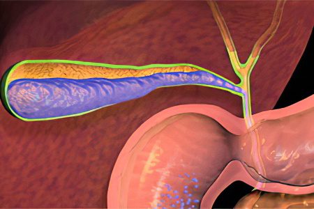 Cholangitis: symptoms and treatment