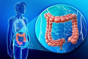 Colonoscopy of the intestine