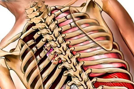 Contusion and fracture of the chest