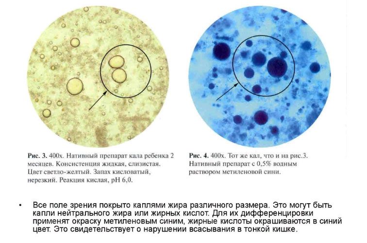 Coprogram: norms and interpretation of results