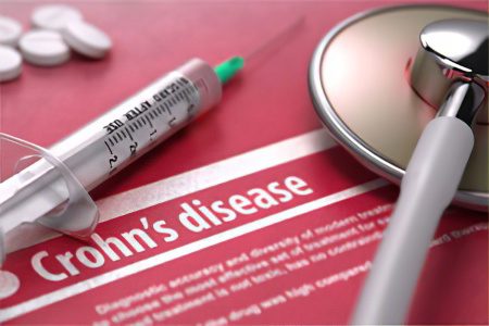 Crohns disease: what is it and how is it treated?