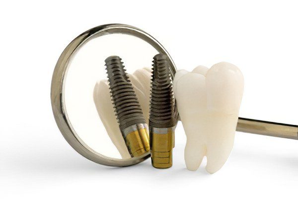 Dental implantation