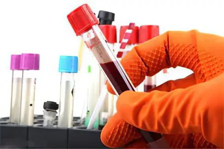 Diagnosis of HIV infection