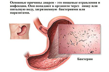 Diarrhea: causes and treatment