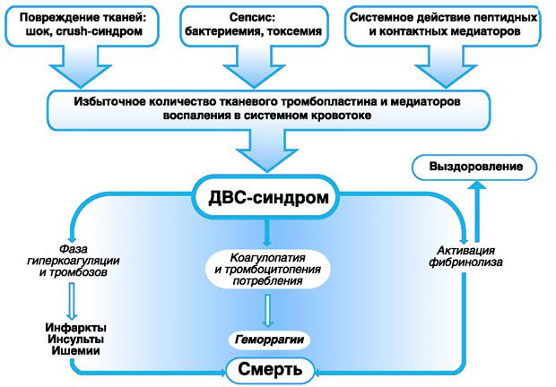 DIC in obstetrics: methods of treatment