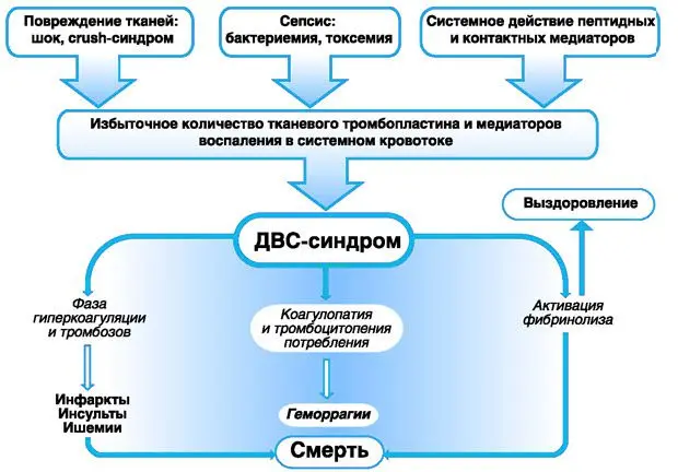 DIC in obstetrics: methods of treatment