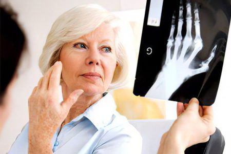 Disability in rheumatoid arthritis