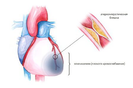 Diseases of the heart and blood vessels, and their symptoms