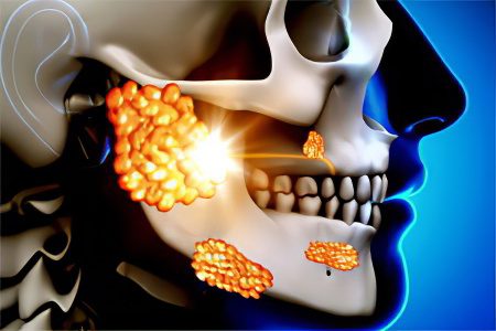 Diseases of the oral mucosa