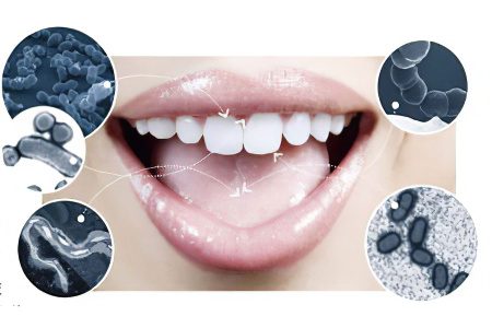 Diseases of the oral mucosa