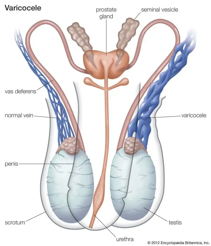 Diseases of the reproductive system in men