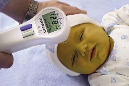 Elevated bilirubin in newborns