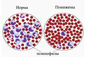 Eosinophils in the blood are elevated, what should I do? What is the norm?