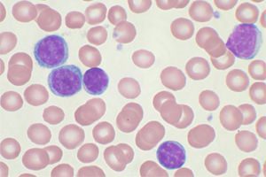 Eosinophils in the blood are elevated, what should I do? What is the norm?