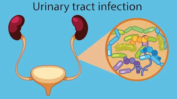 Escherichia coli in men. E. coli treatment