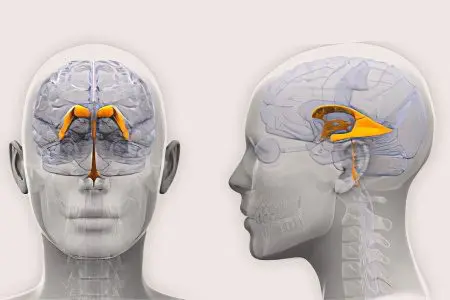 External hydrocephalus of the brain