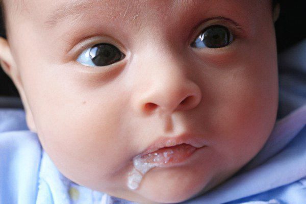 Frequent regurgitation in a newborn, in a baby &#8211; a fountain, after feeding