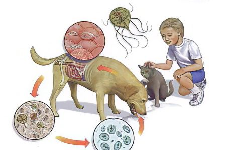 Giardiasis in adults