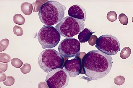 Granulocytes in blood test results